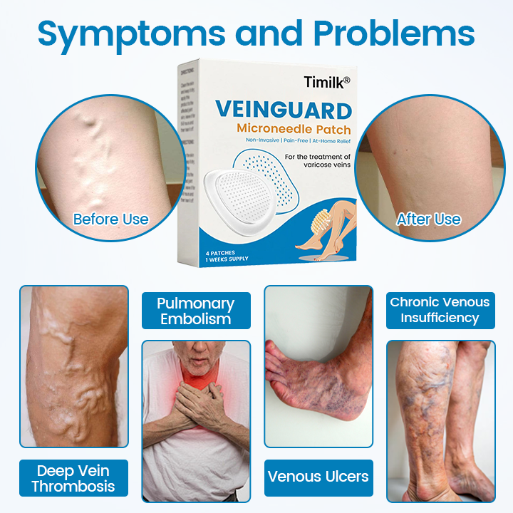Timilk® VeinGuard Microneedle Patch ( Advanced Circulation Support for Varicose & Spider Veins )