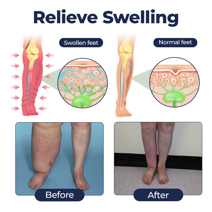 Timilk® SwellRelief Circulation Support Cream❤️‍🔥