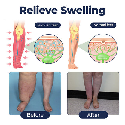 Timilk® SwellRelief Circulation Support Cream❤️‍🔥