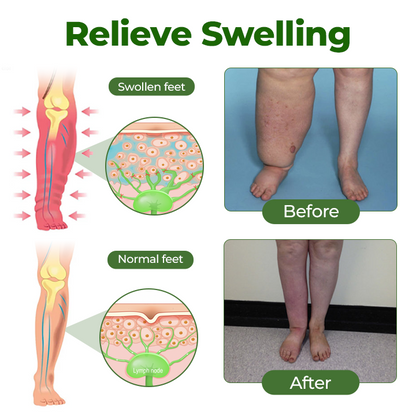 Timilk® Professional Leg Circulation Cream