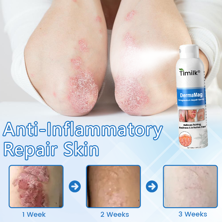 ✅ Official Store: Timilk® DermaMag Magnesium Repair Spray 🔥
