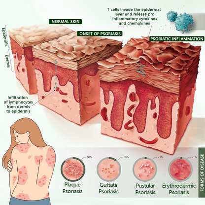 Timilk® DermaPure Tea Tree Healing Cream🔥