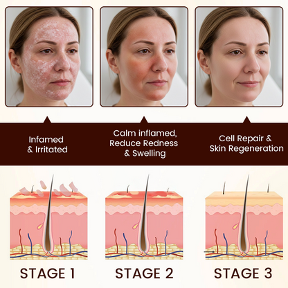 Biancat® Bee Venom Multi-Repair Cream 🔥