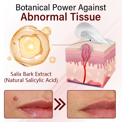 Timilk® Vionara Nano WartErase Patch🔥