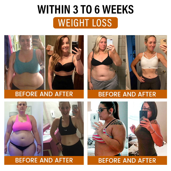 Timilk® SlimFlow Bee Venom Lymphatic Detox Foot Patches