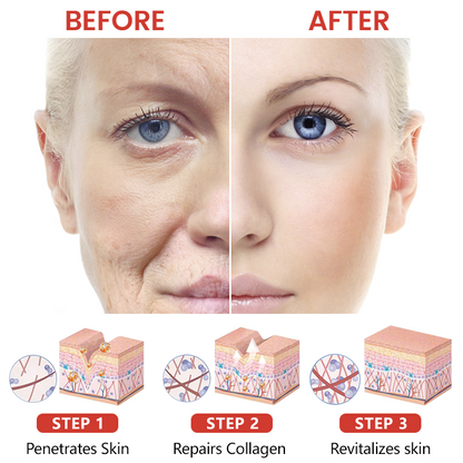 Timilk® PDRN Salmon Extract Firming & Hydrating Serum