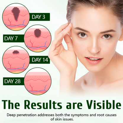 Timilk® DermaPure Tea Tree Healing Cream🔥