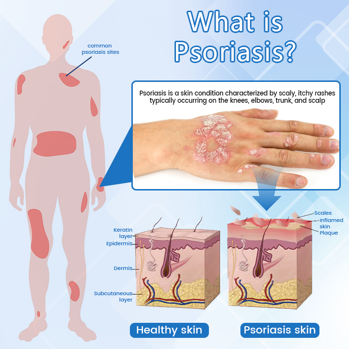 ✅ Official Store: Timilk® DermaMag Magnesium Repair Spray 🔥