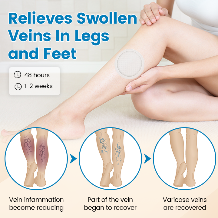 Timilk® VeinGuard Microneedle Patch ( Advanced Circulation Support for Varicose & Spider Veins )