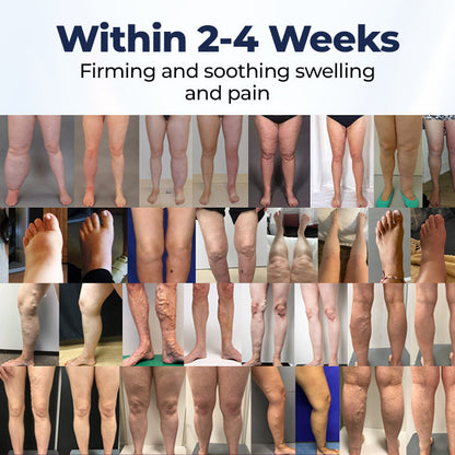 Timilk® SwellRelief Circulation Support Cream❤️‍🔥