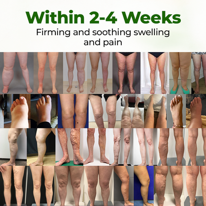 Timilk® Professional Leg Circulation Cream