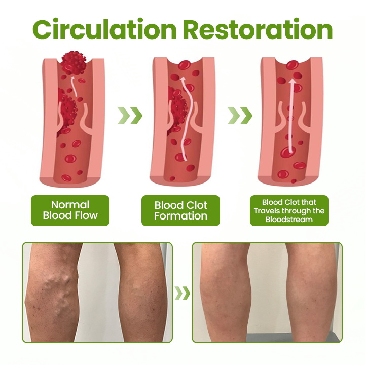 Timilk®VeinEase Leg Mask